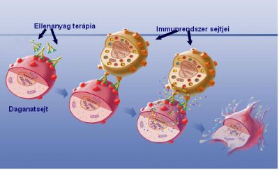 A hasnyálmirigyrák molekuláris diagnosztikája — Molekuláris Diagnosztikával a daganatok ellen