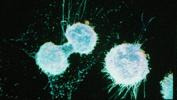 A rák genetikai eredetű, de ritkán öröklött betegség