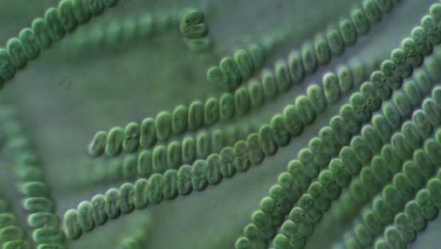Arthrospira platensis (Spirulina) mikroszkp alatt