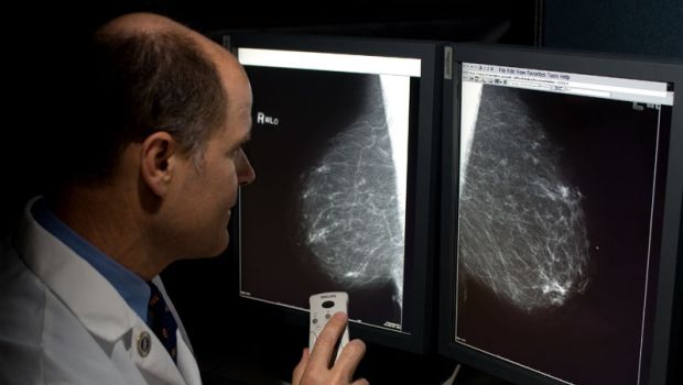 A 45 év feletti nők közel 40 százaléka jár mammográfiára egy új felmérés szerint