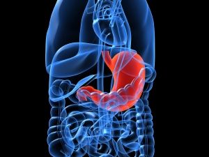 A gyomorrák molekuláris diagnosztikája — Molekuláris Diagnosztikával a daganatok ellen