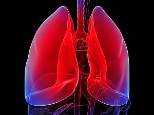Ezek a tényezők hajlamosítanak tüdőrákra - EgészségKalauz