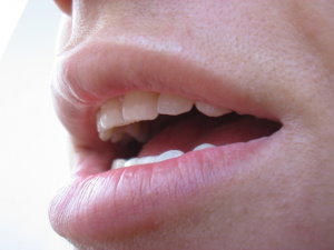 a szájüregi rák átterjed