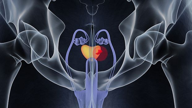 Retrográd ejakuláció: okok, tünetek, kezelés Kompetensek az egészséggel kapcsolatban az iLive-n