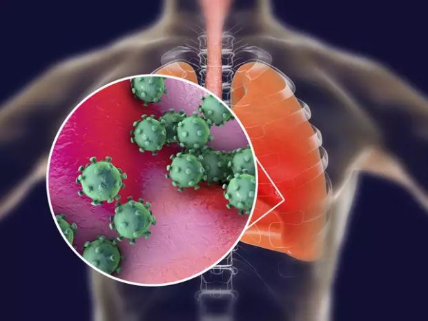 agresszív rák a tüdőben a papilloma vírus gyógyulási százaléka