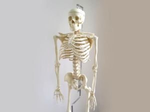 A csontdaganatok leggyakoribb típusai