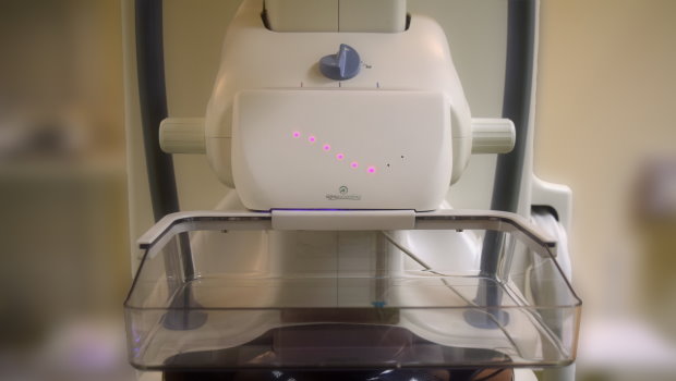 A mammográfra szerelt eszköz kijelzi az asszisztensnek, hogy kinél mekkora nyomást lenne érdemes alkalmazni (Fotó: Academic Medical Center Amsterdam)